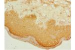 Immunohistochemistry of paraffin-embedded human skin tissue using CSB-PA002304ESR2HU at dilution 1:100