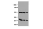 Western blot<br />All lanes : Rat IgG antibody at 2ug/ml<br />
Lane 1 : Rat IgG protein 70ng<br />
Lane 2 : Rat IgG protein 50ng<br />
Lane 3 : Rat IgG protein 30ng<br />
Secondary<br />
Goat polyclonal to Rabbit IgG at 1/50000 dilution