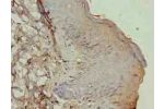 Immunohistochemistry of paraffin-embedded human skin tissue using CSB-PA002316LA01HU at dilution of 1:100