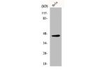 Western Blot analysis of HeLa cells using Elk-1 Polyclonal Antibody