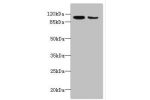 Western blot<br />
All lanes: ATP2A2 antibody at 6ug/ml<br />
Lane 1 : Mouse heart tissue<br />
Lane 2 : Mouse Skeletal muscle tissue<br />
Secondary<br />
Goat polyclonal to Rabbit IgG at 1/10000 dilution<br />
Predicted band size: 115,110,112 kDa<br />

