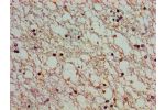 Immunohistochemistry of paraffin-embedded human brain tissue using CSB-PA002339LA01HU at dilution of 1:100