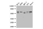 Western Blot<br />
Positive WB detected in:Hela whole cell lysate,K562 whole cell lysate,MCF-7 whole cell lysate,PC3 whole cell lysate,Mouse heart tissue<br />
All lanes: ATP5A1 antibody at 2.5ug/ml<br />
Secondary<br />
Goat polyclonal to rabbit IgG at 1