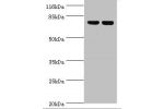 Western blot<br />
All lanes:ATP5A1 antibody at 2ug/ml<br />
Lane 1:Hela whole cell lysate<br />
Lane 2:COLO205 whole cell lysate<br />
Secondary<br />
Goat polyclonal to rabbit at 1/10000 dilution<br />
Predicted band size: 60,55,58 kDa<br />
Observed ba