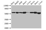 Western Blot<br />
Positive WB detected in:Hela whole cell lysate,HepG2 whole cell lysate,A549 whole cell lysate,Mouse heart tissue,Mouse liver tissue,Mouse brain tissue,Rat heart tissue,Mouse liver tissue<br />
All lanes:ATP5B antibody at 2.7