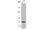 Western Blot analysis of HepG2 cells using EOMES Polyclonal Antibody