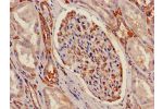 Immunohistochemistry of paraffin-embedded human kidney tissue using CSB-PA002353LA01HU at dilution of 1:100