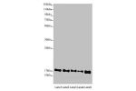 Western blot<br />
All lanes:ATP5D antibody at 2.44 ug/ml<br />
Lane 1 : Mouse heart tissue<br />
Lane 2 : Raji whole cell lysate<br />
Lane 3 : NIH/3T3 whole cell lysate<br />
Lane 4 : A549 whole cell lysate<br />
Lane 5 : HepG-2 whole cell lysate<br />
