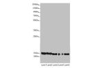 Western blot<br />
All lanes:ATP5D antibody at 1.94 ug/ml<br />
Lane 1 : Raji whole cell lysate<br />
Lane 2 : NIH/3T3 whole cell lysate<br />
Lane 3 : A549 whole cell lysate<br />
Lane 4 : MDA-MB-231 whole cell lysate<br />
Lane 5 : HepG-2 whole cell lys