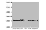 Western blot<br />
All lanes:ATP5H antibody at 5.16 ug/ml<br />
Lane 1 : Mouse kidney tissue<br />
Lane 2 : Mouse liver tissue<br />
Lane 3 : Mouse brain tissue<br />
Lane 4 : Hela whole cell lysate<br />
Lane 5 : HepG-2 whole cell lysate<br />
Lane 6 : P
