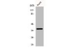 Western Blot analysis of Jurkat cells using Ephrin-A3 Polyclonal Antibody