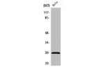 Western Blot analysis of HeLa cells using Ephrin-A5 Polyclonal Antibody