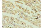 Immunohistochemistry of paraffin-embedded human heart using CSB-PA002379ESR1HU at dilution 1:100
