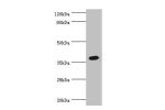 Western blot<br />
All lanes:Renin receptor antibody at 2ug/ml+Hela whole cell lysate<br />
Secondary<br />
Goat polyclonal to rabbit at 1/10000 dilution<br />
Predicted band size: 40,36 kDa<br />
Observed band size: 39 kDa<br />