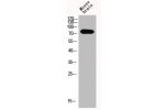 Western Blot analysis of MOuse-brain cells using Epsin 1 Polyclonal Antibody