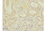 Immunohistochemistry of paraffin-embedded human kidney tissue CSB-PA002390ESR2HU at dilution 1:100