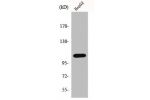 Western Blot analysis of rat lung cells using ERAP1 Polyclonal Antibody