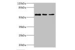 Western blot<br />
All lanes:ATP6V1B2 antibody at 5ug/ml<br />
Lane 1:Hela whole cell lysate<br />
Lane 2:rat brain tissue<br />
Lane 3:mouse heart tissue<br />
Secondary<br />
Goat polyclonal to rabbit at 1/10000 dilution<br />
Predicted band size: 57kDa