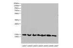 Western blot<br />
All lanes: ATP6V1G2 antibody at 12ug/ml<br />
Lane 1 : Rat heart tissue<br />
Lane 2 : Mouse spleen tissue<br />
Lane 3 : Hela whole cell lysate<br />
Lane 4 : HepG-2 whole cell lysate<br />
Lane 5 : A549 whole cell lysate<br />
Lane 6 