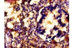 IHC image of CSB-PA863972LA01HU diluted at 1:500 and staining in paraffin-embedded human lung tissue performed on a Leica BondTM system. After dewaxing and hydration, antigen retrieval was mediated by high pressure in a citrate buffer (pH 6.0). Section wa