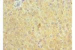 Immunohistochemistry of paraffin-embedded human liver using CSB-PA002415ESR2HUat dilution 1:100