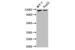 Western Blot<br />
Positive WB detected in:MCF-7 whole cell lysate,HepG2 whole cell lysate<br />
All lanes:ATP9A antibody at 3.5