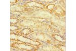 Immunohistochemistry of paraffin-embedded human kidney tissue using CSB-PA002437LA01HU at dilution of 1:100