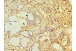 Immunohistochemistry of paraffin-embedded human gallbladder using CSB-PA002438ESR2HU at dilution 1:100