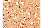 Immunohistochemistry of paraffin-embedded human brain tissue using CSB-PA002440LA01HU at dilution of 1:100