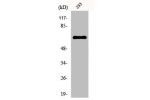 Western Blot analysis of 293 cells using ERa Polyclonal Antibody
