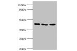 Western blot<br />
All lanes:ATXN3 antibody at 2ug/ml<br />
Lane 1:293T whole cell lysate<br />
Lane 2:Mouse brain tissue<br />
Lane 3:MCF-7 whole cell lysate<br />
Secondary<br />
Goat polyclonal to rabbit at 1/10000 dilution<br />
Predicted band size: 4
