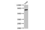 Western Blot<br />
Positive WB detected in:Rat lung tissue<br />
All lanes:ATXN7 antibody at 3.3