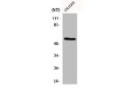 Western Blot analysis of COLO205 cells using ER