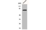 Western Blot analysis of COLO205 cells using EWS Polyclonal Antibody