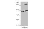 Western blot<br />
All lanes