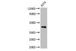Western Blot<br />
Positive WB detected in:A375 whole cell lysate<br />
All lanes:AURKC antibody at 3.2