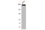 Western Blot analysis of HuvEc cells using Factor VIII Polyclonal Antibody