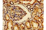 Immunohistochemistry of paraffin-embedded human kidney tissue using CSB-PA002470LA01HU at dilution of 1:100
