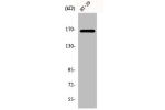 Western Blot analysis of HT29 cells using FANCD2 Polyclonal Antibody