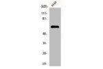 Western Blot analysis of A549 cells using FAST Polyclonal Antibody
