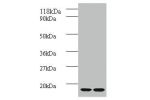 All lanes: Beta-2-microglobulin antibody at 2ug/ml<br />
Lane 1 : A431 whole cell lysate<br />
Lane 2 : mouse lungs tissue<br />
Secondary<br />
Goat polyclonal to Rabbit IgG at 1/10000 dilution<br />
Predicted band size: 12kDa<br />
Observed band size: 1