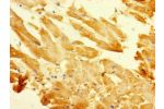 Immunohistochemistry of paraffin-embedded human heart tissue using CSB-PA002491LA01HU at dilution of 1:100