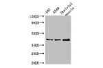 Western Blot<br />
Positive WB detected in:U87 whole cell lysate,A549 whole cell lysate,Mouse skeletal muscle tissue<br />
All lanes:B3GALT4 antibody at 3