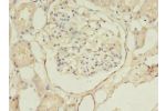 Immunohistochemistry of paraffin-embedded human kidney using CSB-PA002499EA01HU at dilution 1:100