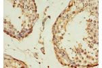 Immunohistochemistry of paraffin-embedded human testis using CSB-PA002503EA01HU at dilution 1:100