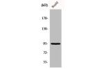 Western Blot analysis of HuvEc cells using Fer Polyclonal Antibody