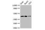 Western Blot<br />
Positive WB detected in:A549 whole cell lysate,HepG2 whole cell lysate,U251 whole cell lysate<br />
All lanes:B4GALT2 antibody at 3.5