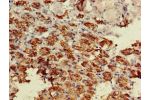 Immunohistochemistry of paraffin-embedded human adrenal gland tissue using CSB-PA002524LA01HU at dilution of 1:100