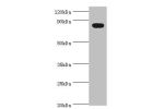 Western blot<br />
All lanes:BACH1 antibody at 2ug/ml+mouse thymus tissue<br />
Secondary<br />
Goat polyclonal to rabbit at 1/10000 dilution<br />
Predicted band size: 82kDa<br />
Observed band size: 82kDa<br />