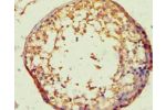 Immunohistochemistry of paraffin-embedded human testis using CSB-PA002526ESR2HU at dilution 1:100